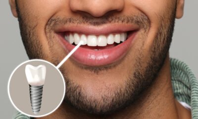 Dental Implants Newcastle
