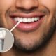 Dental Implants Newcastle