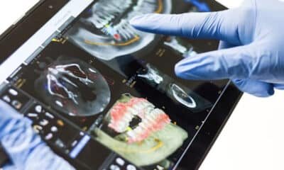 Nerovet AI Dentistry: A New Way to Get Safer, Faster, and Personalized Care