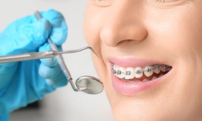 orthodontics