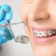 orthodontics