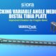 Tibia