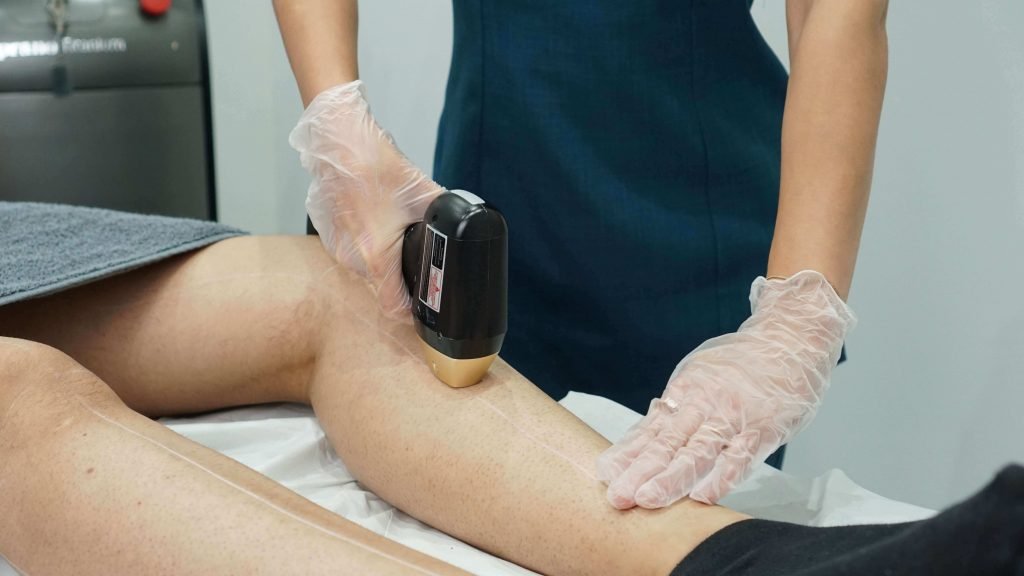 How Laser Hair Removal Works