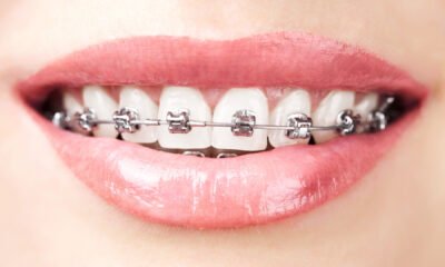 Orthodontic