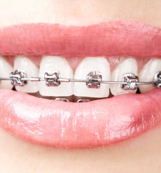 Orthodontic