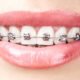 Orthodontic