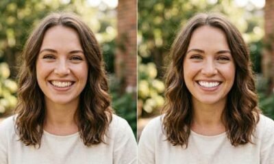 Teeth