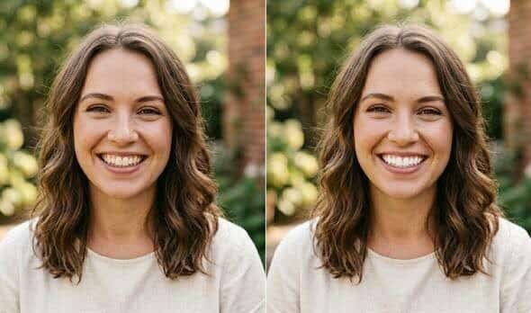 Teeth