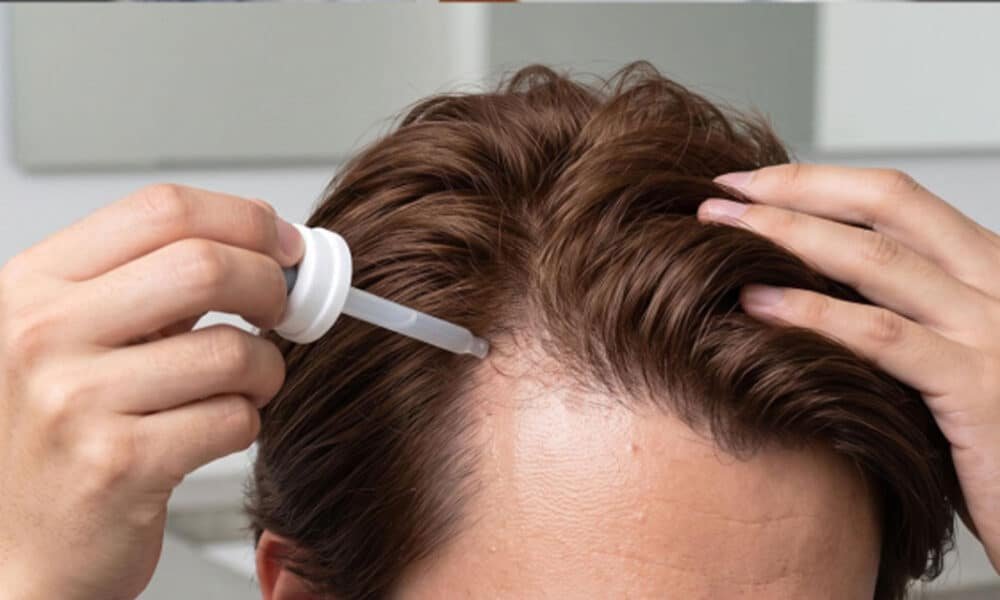 Hair Loss Treatment for Men Effective Solutions to Prevent Thinning