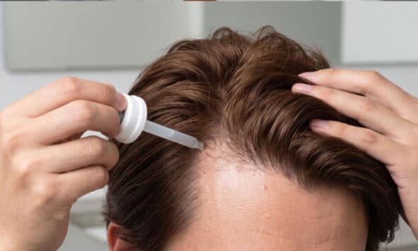 Hair Loss Treatment for Men Effective Solutions to Prevent Thinning